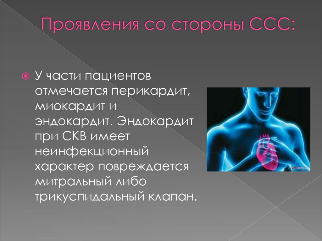 Проявление со стороны. Симптомы со стороны сердечно сосудистой системы. Системная красная волчанка сердечно-сосудистая система. Брюшной тиф сердечно сосудистая система. Системная красная волчанка поражения сердечно сосудистой системы.