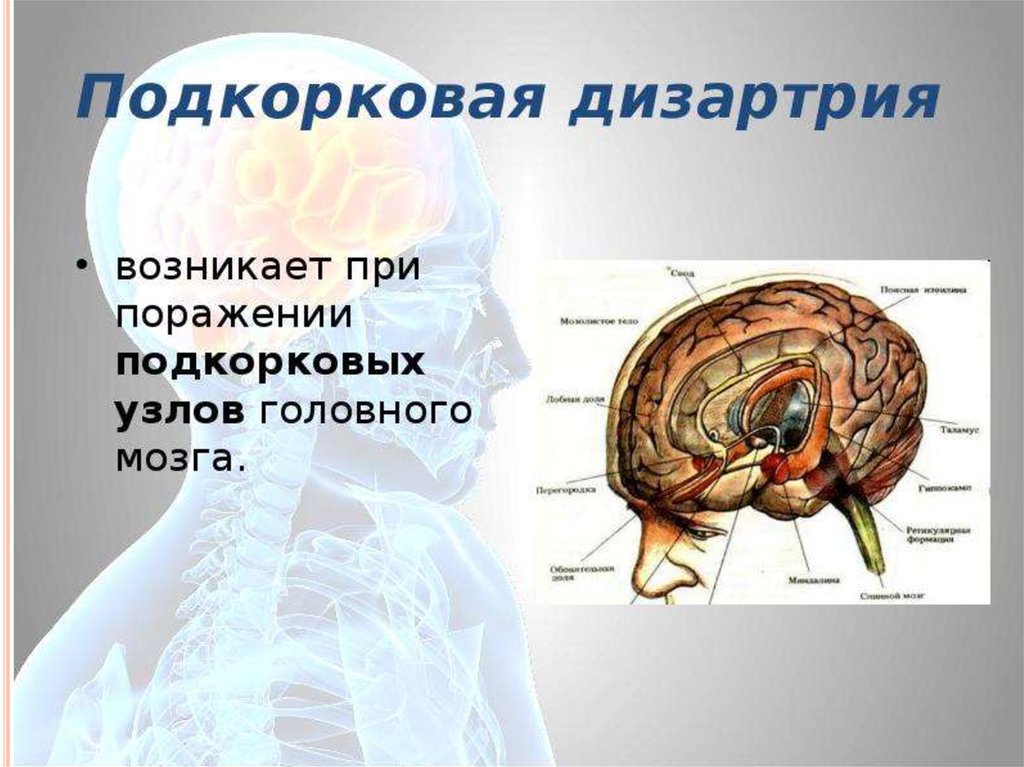 Дизартрия на резидуальном перинатальном фоне