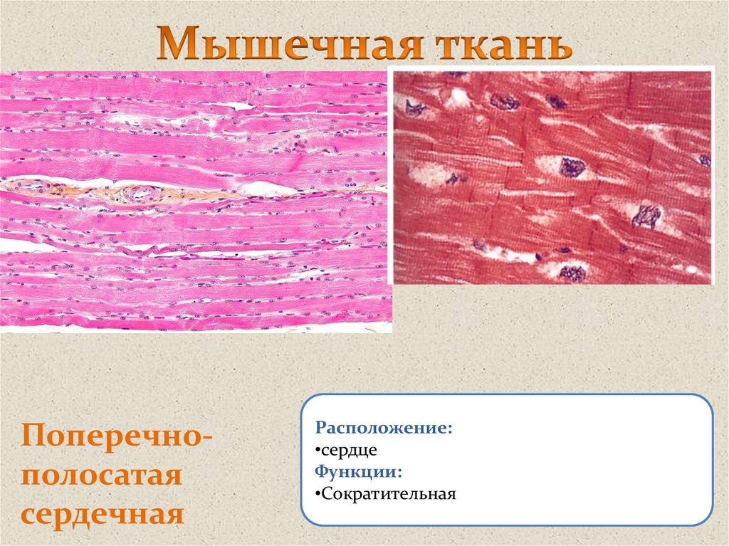 Функция поперечно полосатой сердечной. Поперечно полосатая мышечная ткань. Местоположение мышечной ткани. Местоположение поперечно полосатой мышечной ткани. Поперечно полосатая сердечная ткань расположение.