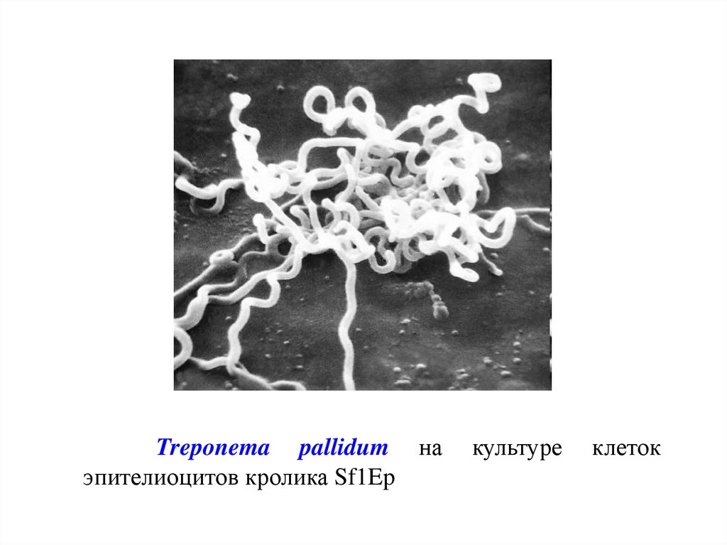 Treponema pallidum в рмп. Трепонемы микробиология. Бледная трепонема возбудитель. Трепонема классификация. Возбудитель сифилиса микробиология.