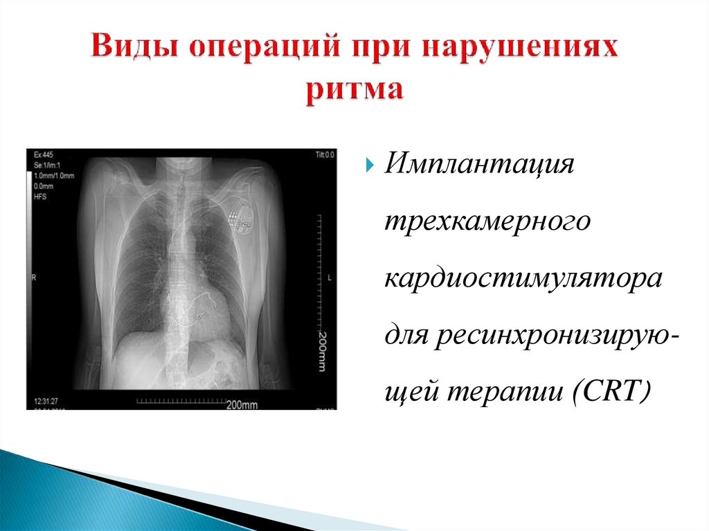 Виды оперативного лечения