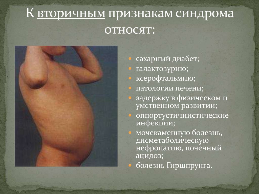 К вторичным признакам синдрома относят: