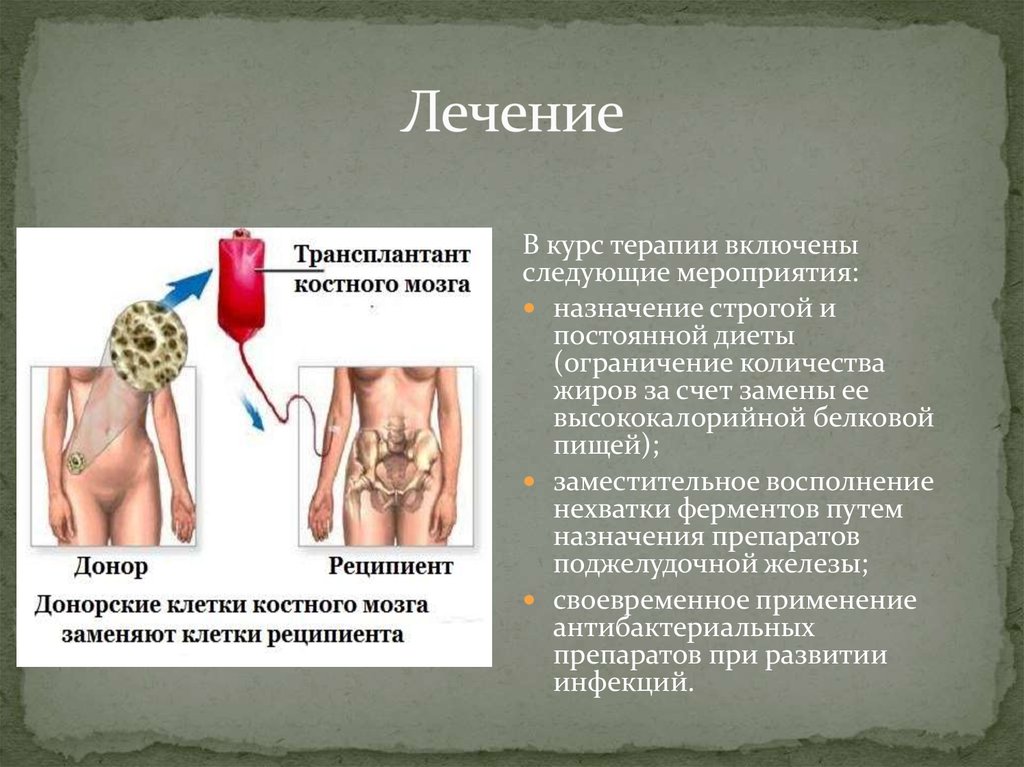 Швахмана даймонда синдром фото