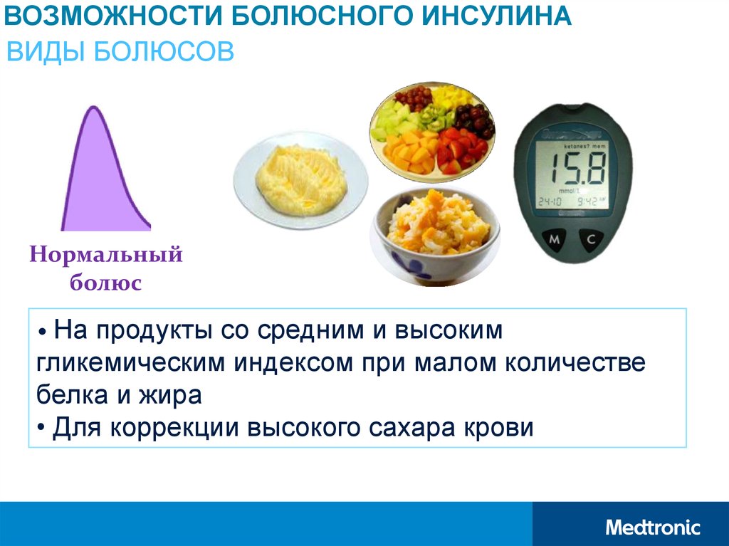 Помповая инсулинотерапия презентация