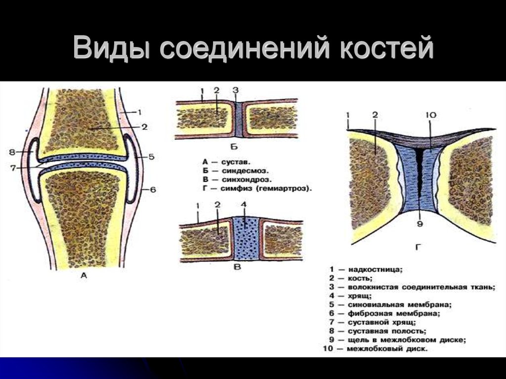 На рисунке изображен сустав