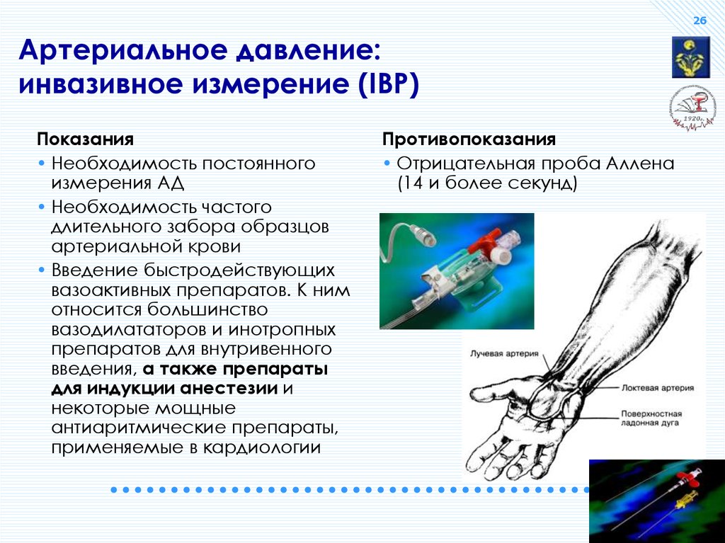 Прямое давление на артерию