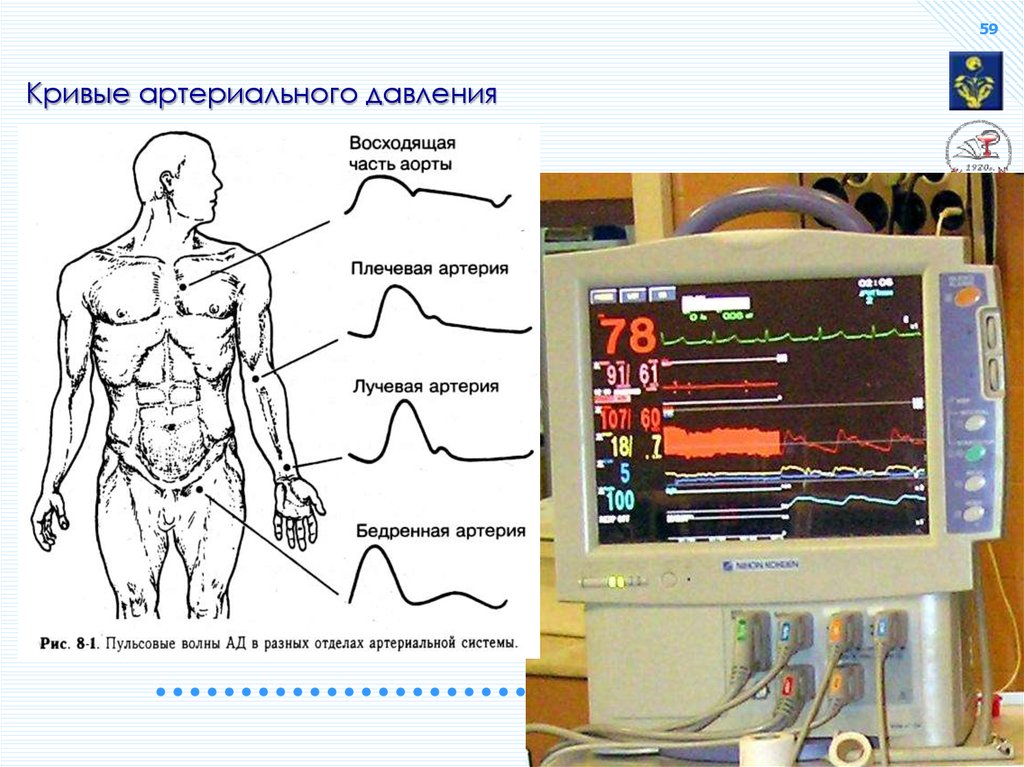 Кривая артериального давления. Кривая кровяного давления. Анализ Кривой артериального давления. Мониторинг гемодинамики.