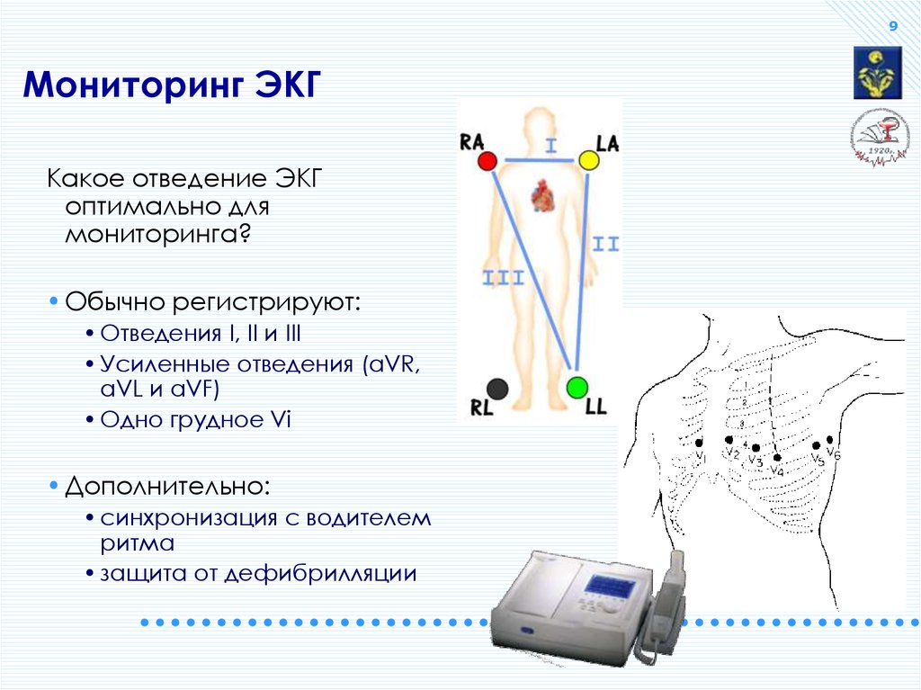 Экг отведения фото