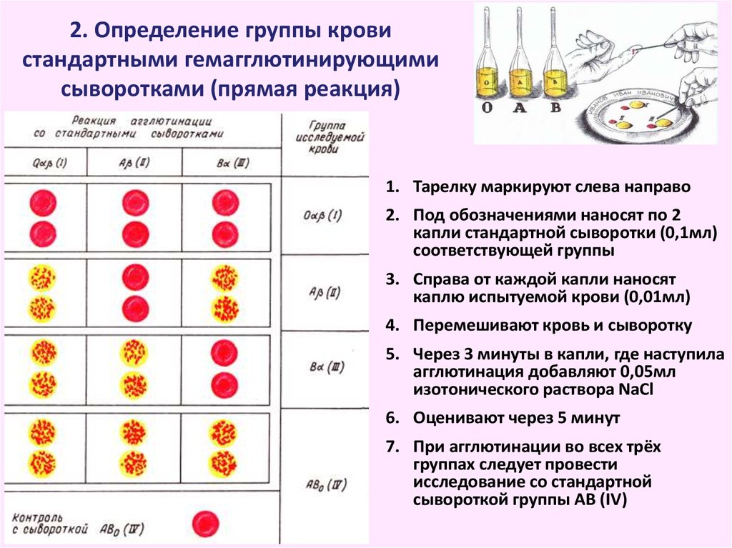 Схема определения группы крови по стандартным сывороткам