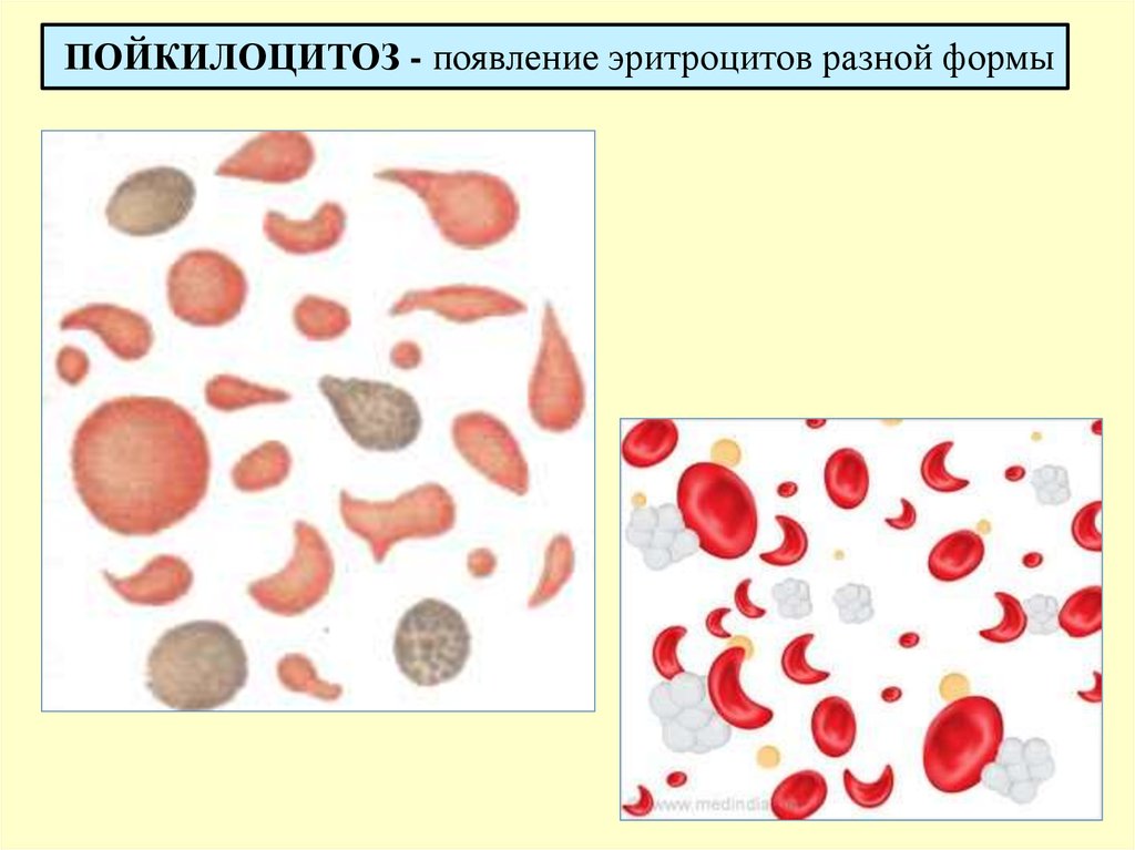 Посмотрите на изображение эритроцитов в разной среде в каком