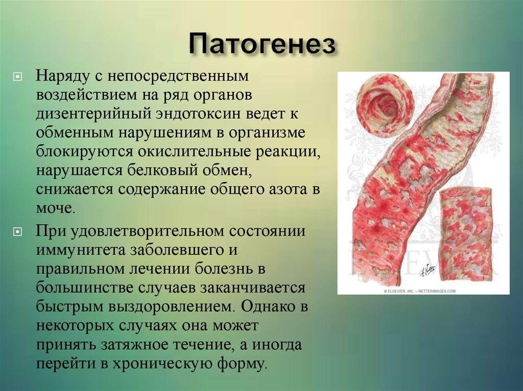 Патогенез дизентерии схема