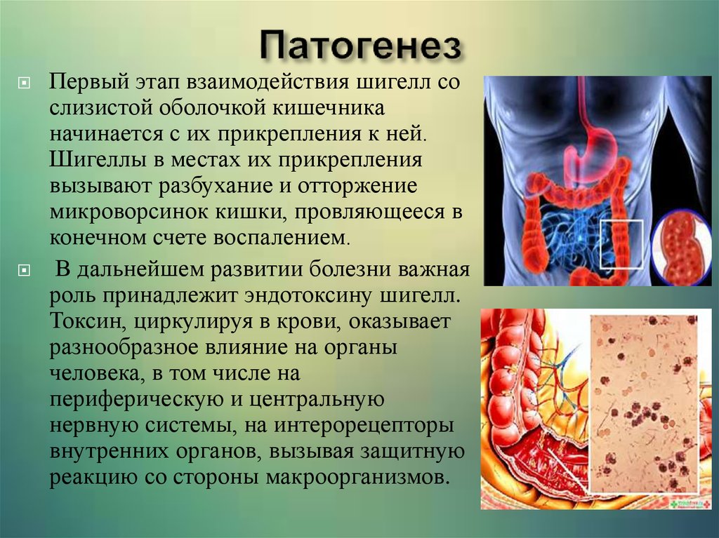 Лечение и профилактика дизентерии