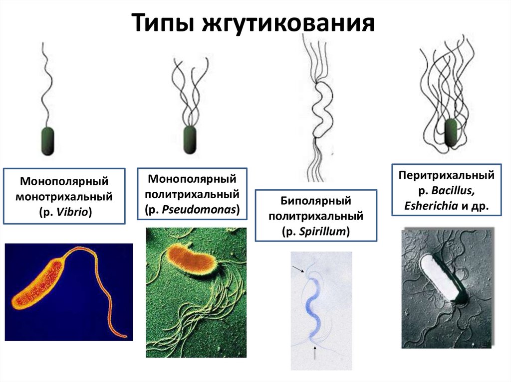 Форма тела жгутиков. Монотрихи перитрихи. Монотрих расположение жгутиков. Монотрихи лофотрихи амфитрихи. Типы жгутикования бактерий.