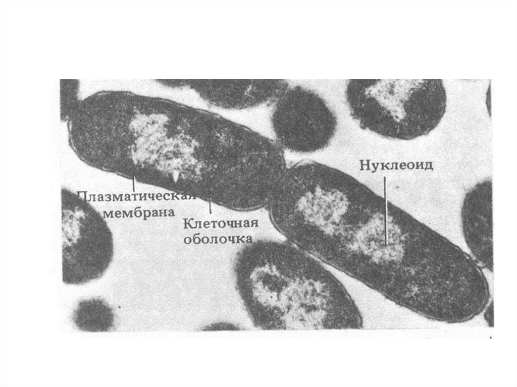 Нуклеоид прокариот. Нуклеоид бактерий микробиология. Нуклеоид бактерий строение. Нуклеоид у прокариот. Нуклеоид в прокариотической клетке.