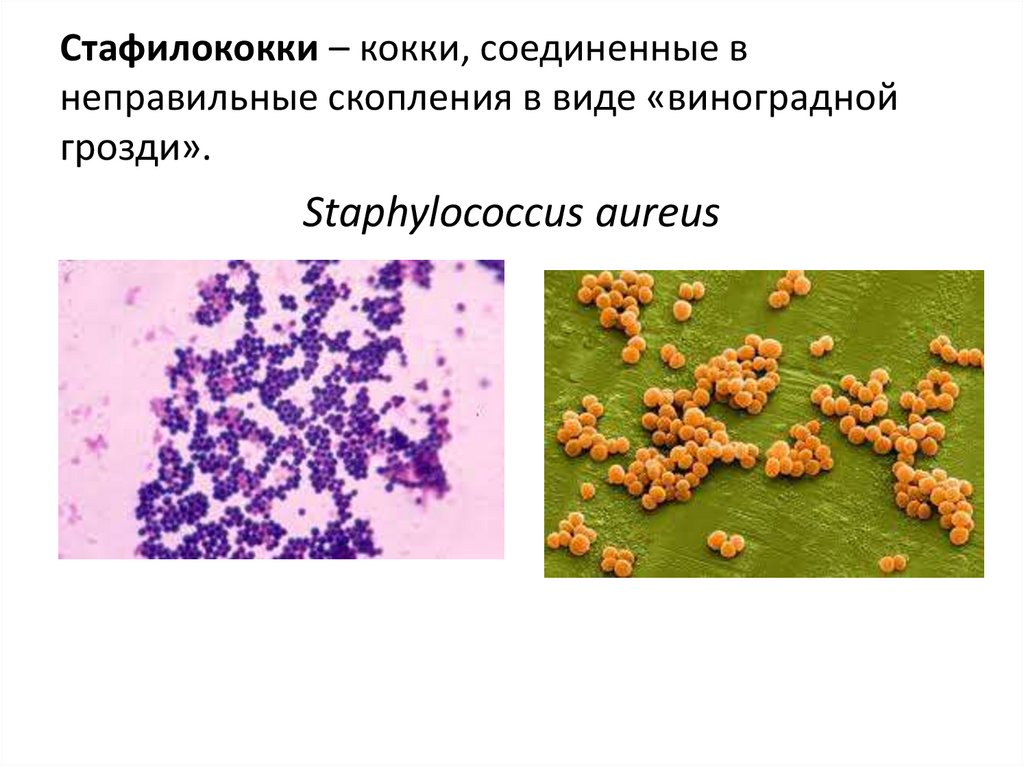 Стафилококк виды. Стафилококкус ауреус морфология. Виноградная гроздь грамположительные кокки стафилококки. Золотистый стафилококк строение клетки. Кокки стафилококки.