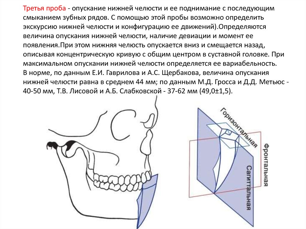 Движение нижней челюсти в сторону