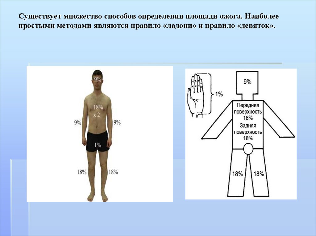 Какая площадь ожога показана на картинке