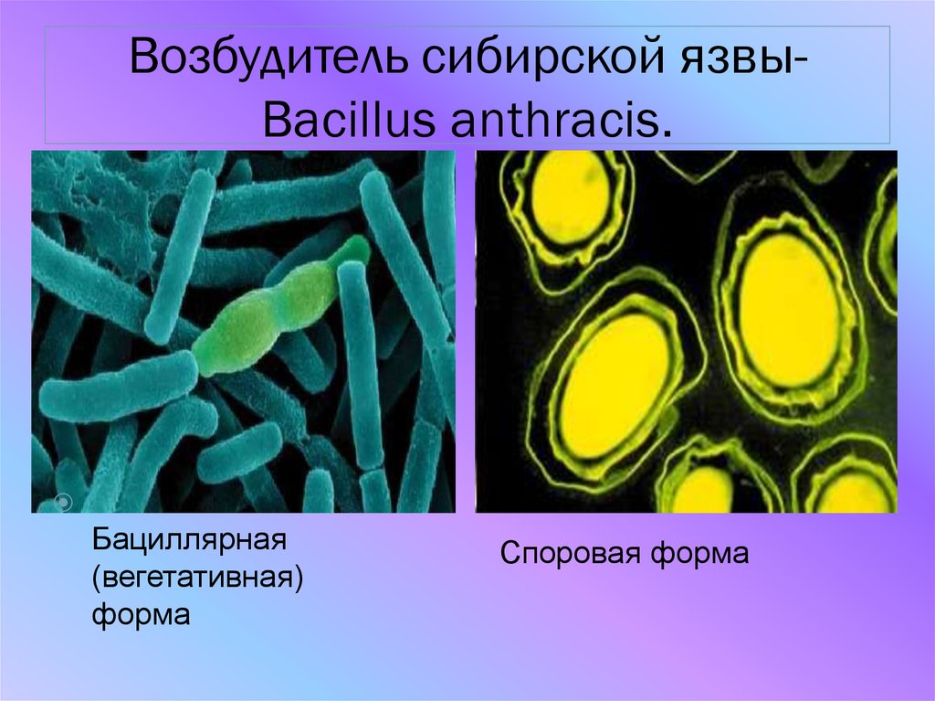 В скотомогильниках бактерии очень опасного заболевания. Споры бацилл сибирской язвы. Bacillus anthracis, а22 (Сибирская язва). Возбудитель – Bacillus anthracis. Сибиреязвенная бацилла микробиология.