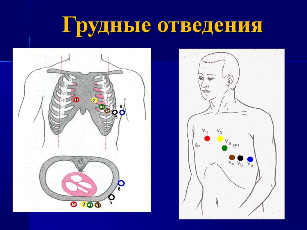 Левые отведения. Грудные отведения что смотрят.