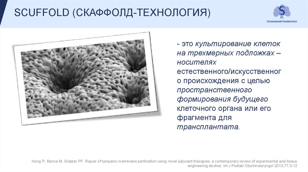 SCUFFOLD (СКАФФОЛД-ТЕХНОЛОГИЯ)