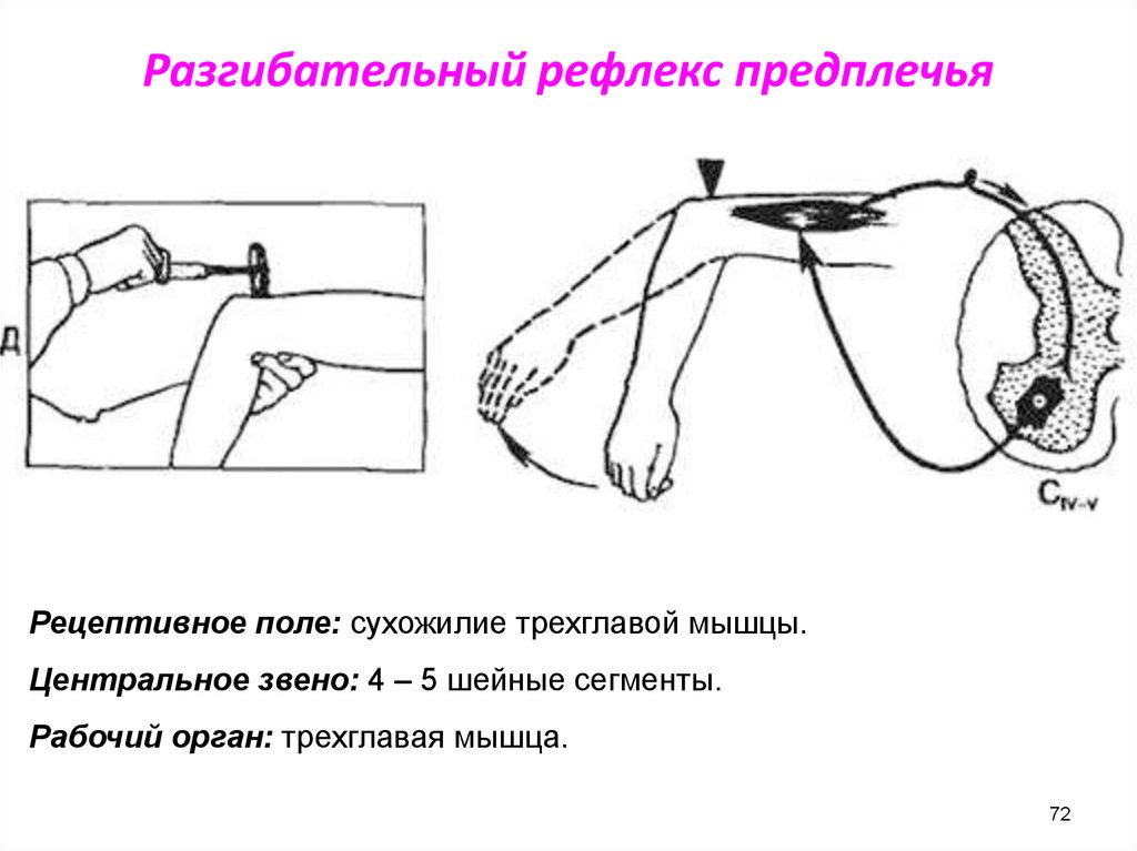 Схема сухожильного рефлекса