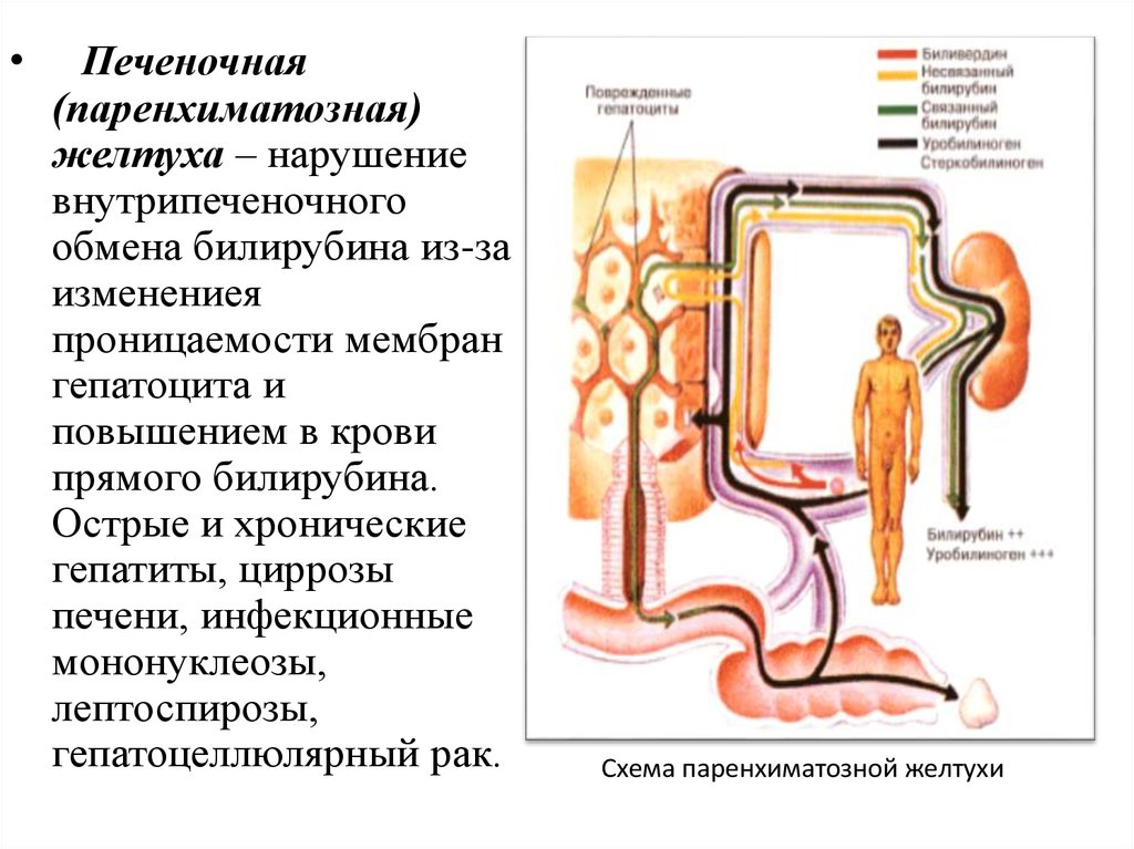 Паренхиматозная желтуха схема