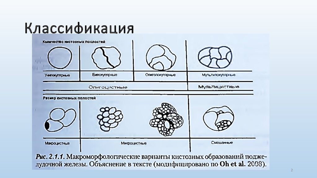 Классификация груди картинка