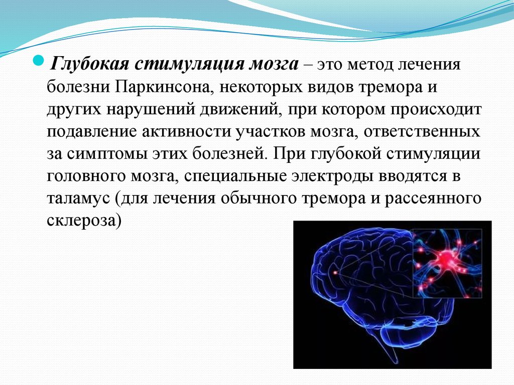 Как стимулировать мозг. Глубокая стимуляция мозга при болезни Паркинсона. Электроды в головной мозг. Глубинная стимуляция головного мозга. Стимуляция мозга стимуляция мозга.