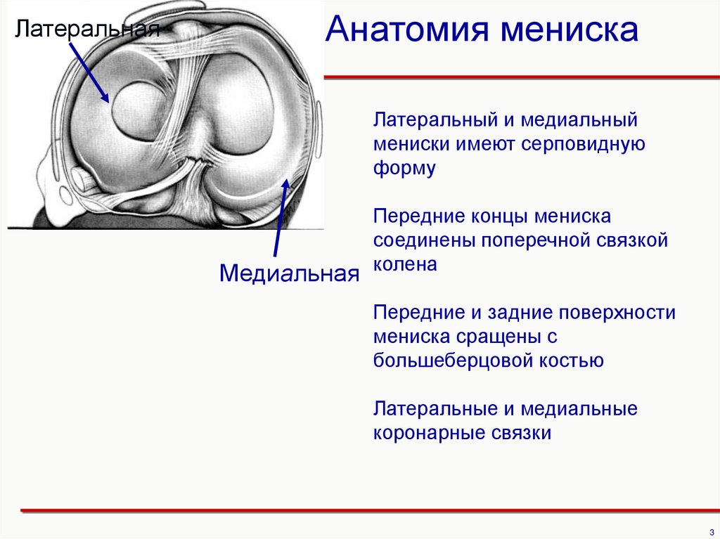 Лечение латерального мениска