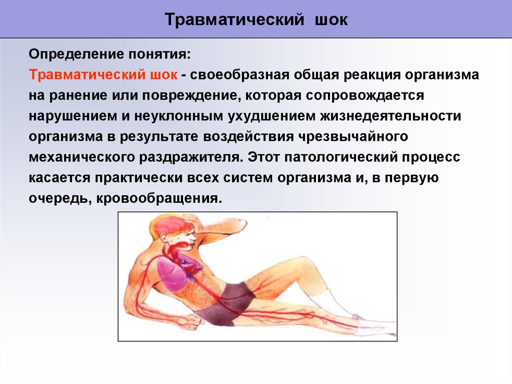 Травматический шок хирургия презентация