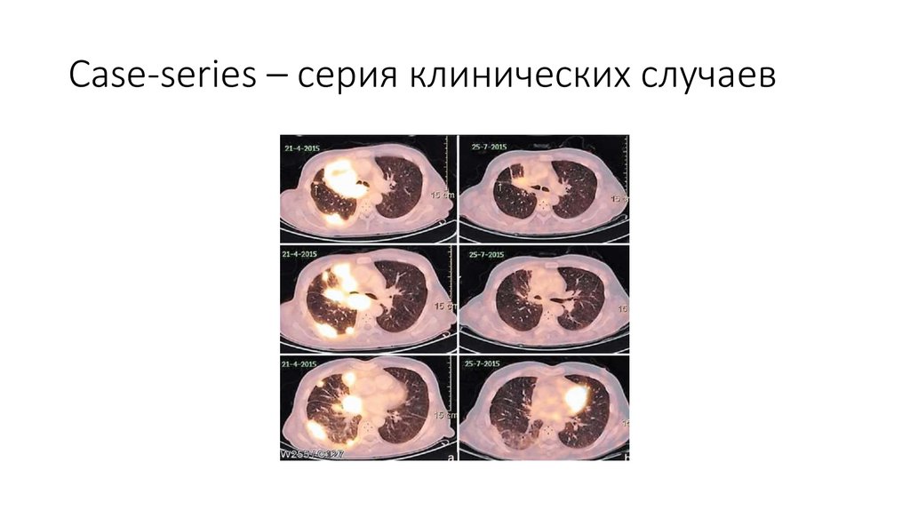 Case-series – серия клинических случаев