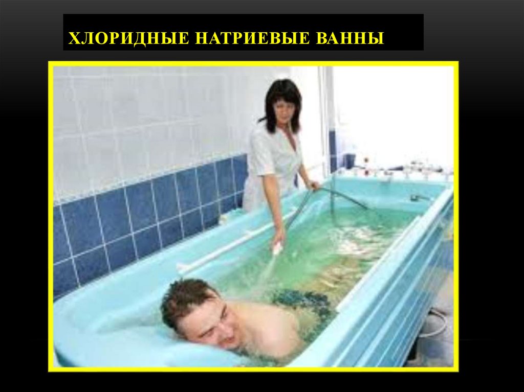 Хлоридные натриевые ванны