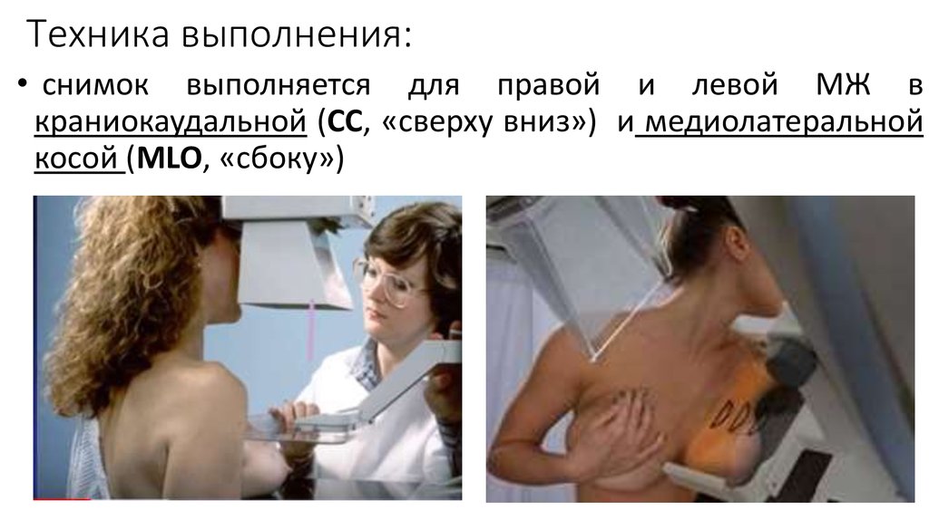 Техника выполнения:
