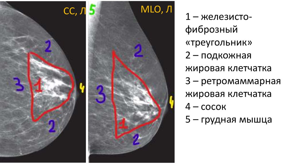 Маммография код