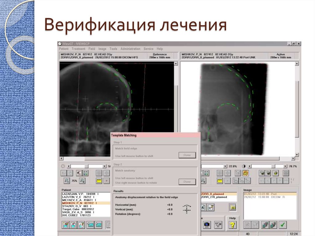 Злокачественные опухоли лучевая диагностика