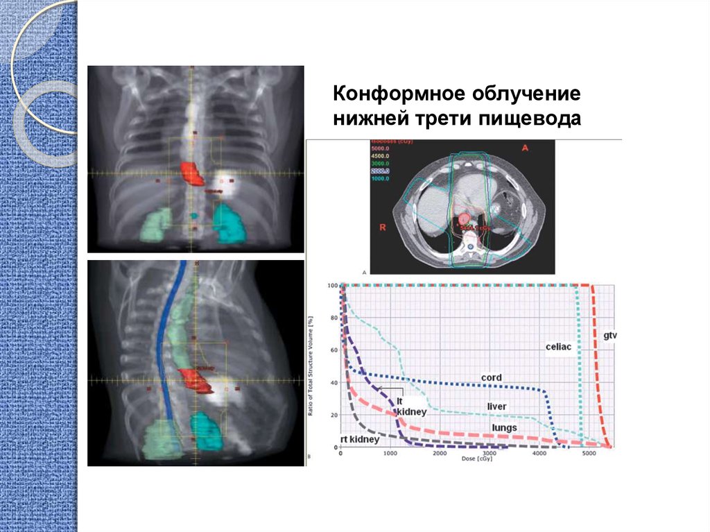 После лучевая побочные эффекты