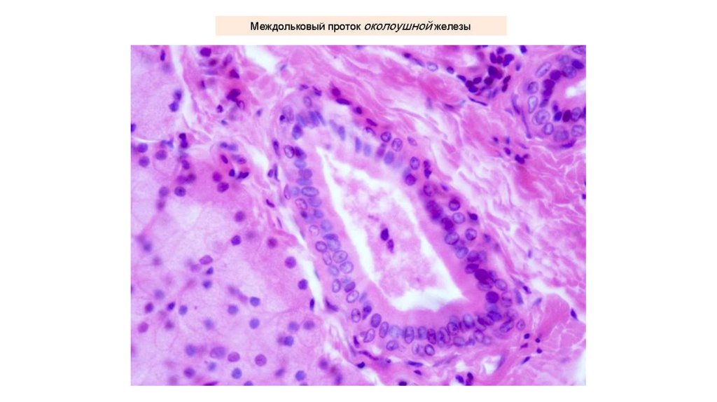 Проток железы. Междольковый выводной проток поджелудочной железы гистология. Междольковый проток околоушной железы. Железы Овербека гистология. Проток околоушной железы гистология.