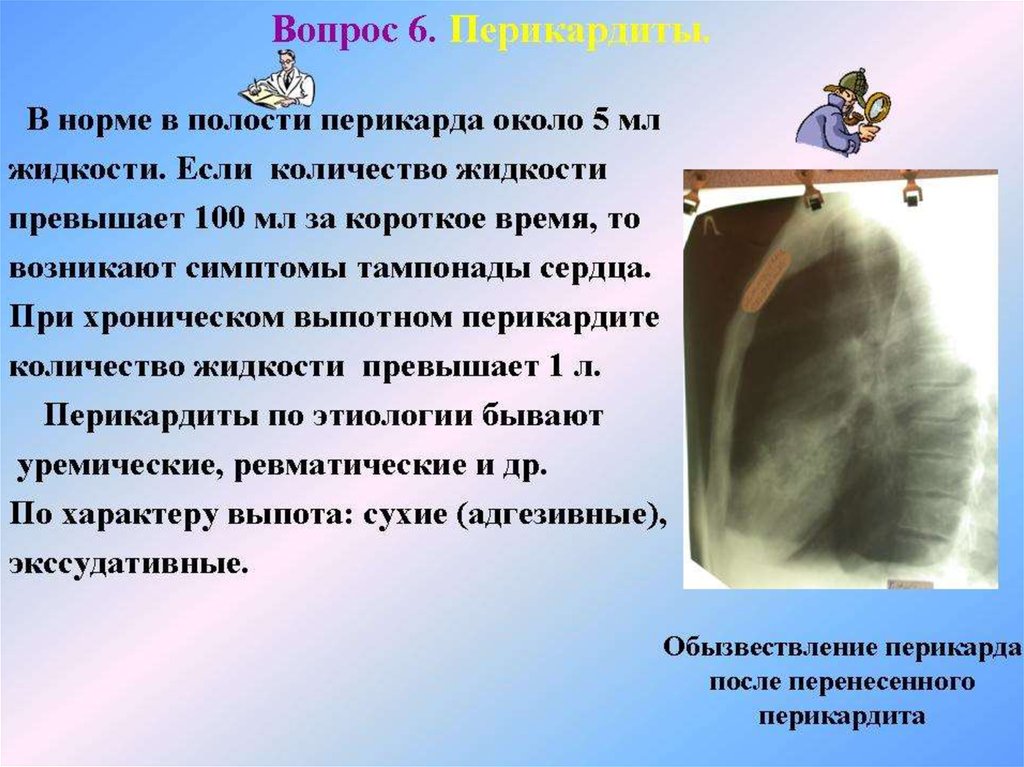 Жидкость в перикарде. Выявление жидкости в полости перикарда. Диагностика выпота в полости перикарда. Жидкость в перикарде норма и патология. Рентгенологические системы для сердечно сосудистое системы.