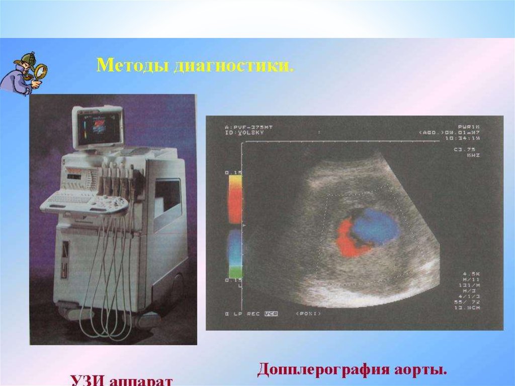 Лучевая диагностика сердечно сосудистой системы презентация