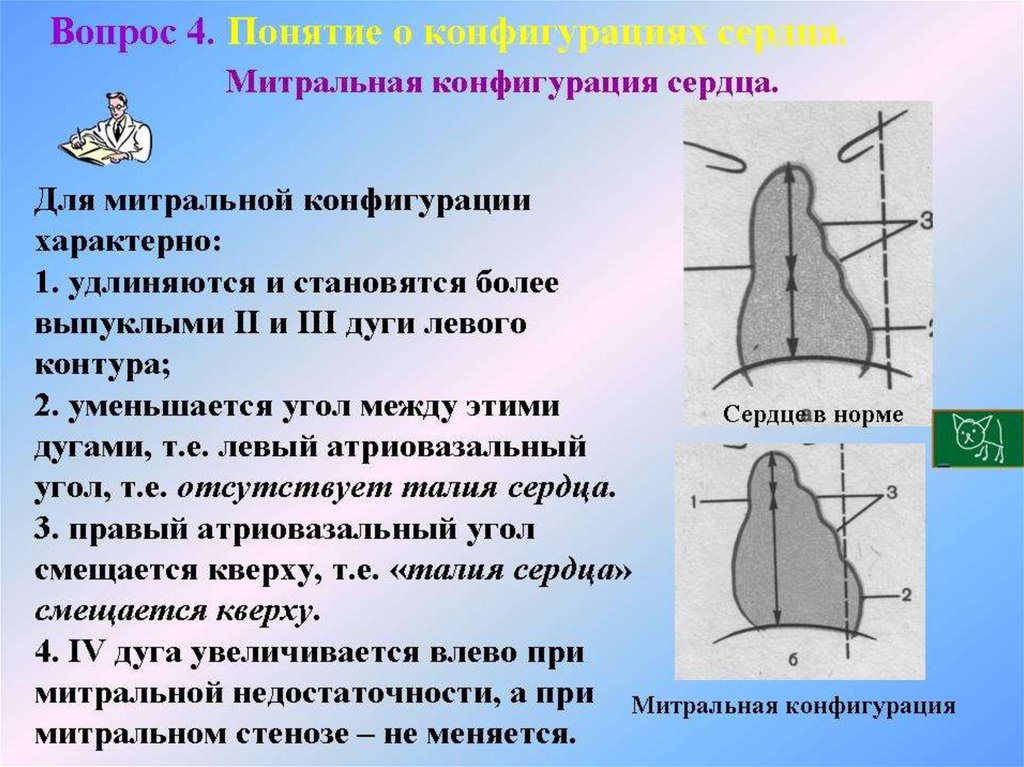 Конфигурация сердца аортальная схема