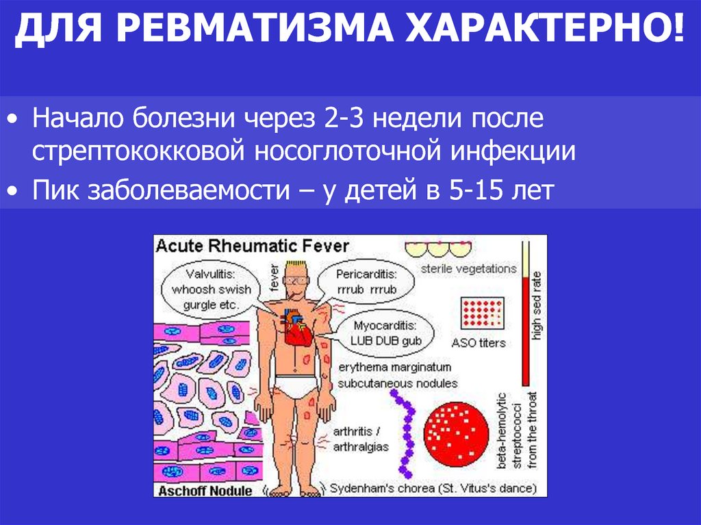 Ревматизм патогенез