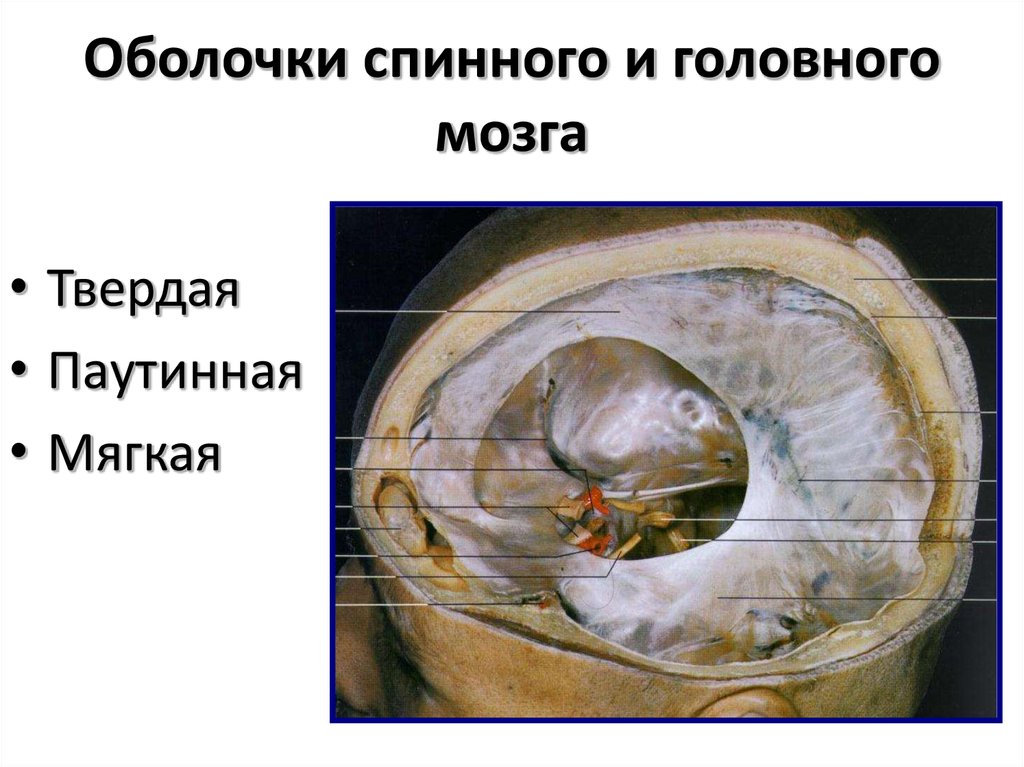 Особенности оболочек головного мозга. Оболочки спинного и головногтмозга. Твердая оболочка спинного мозга. Оболочки головного мозга. Твёрдая оболочка головного мозга.