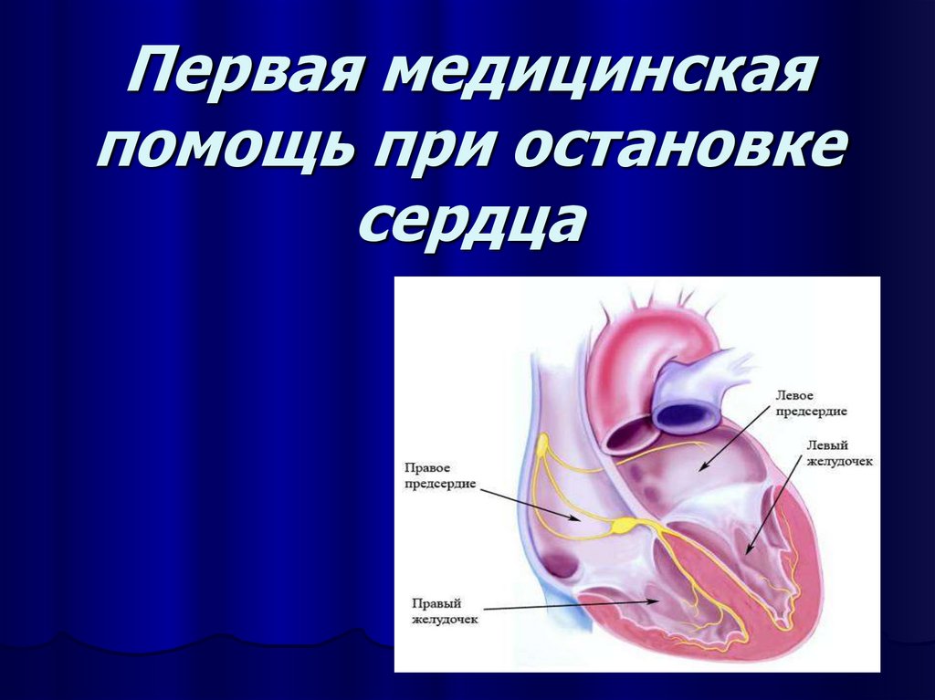 Первая помощь при остановке сердца картинки