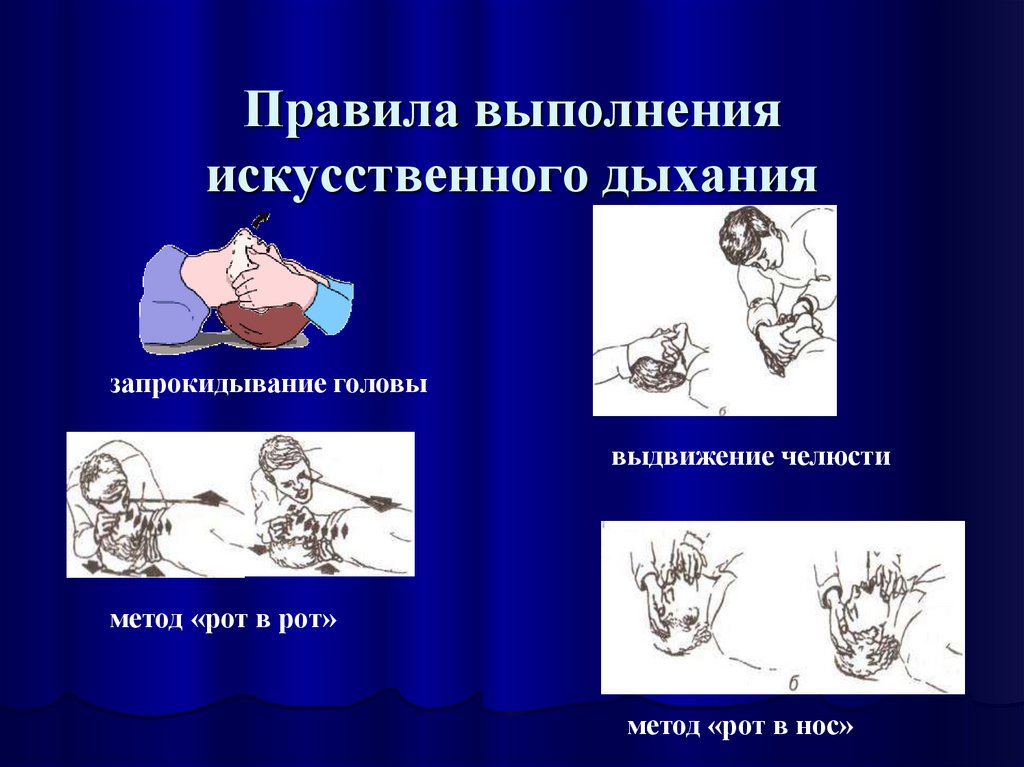 Проведение искусственного дыхания