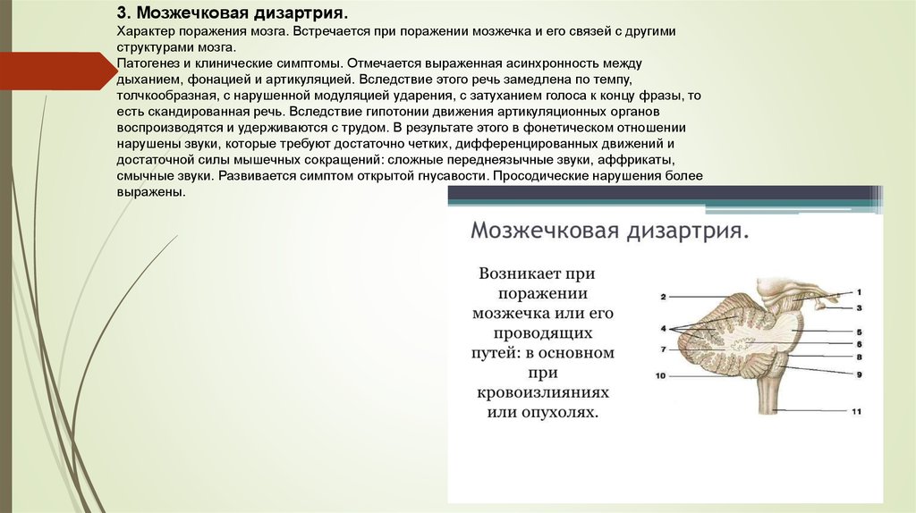 Мозжечковая дизартрия презентация