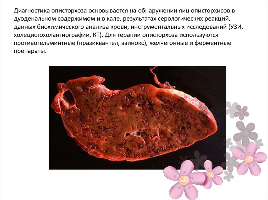 Определение Opistorchis felineus (Описторхоз), [Real-Time PCR] в кале