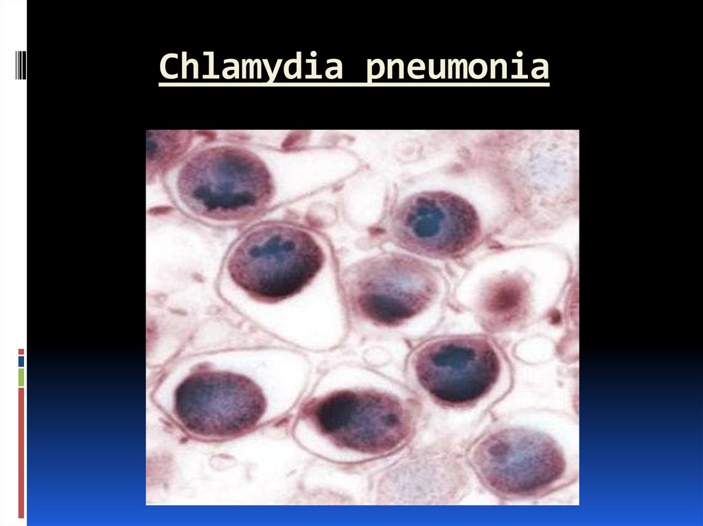 Хламидия chlamydia. Chlamydophila pneumoniae морфология. Хламидия пневмония под микроскопом. Chlamydophila pneumoniae эпидемиология.