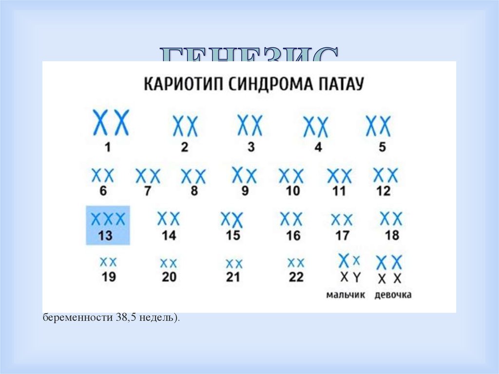 Синдром мориса презентация