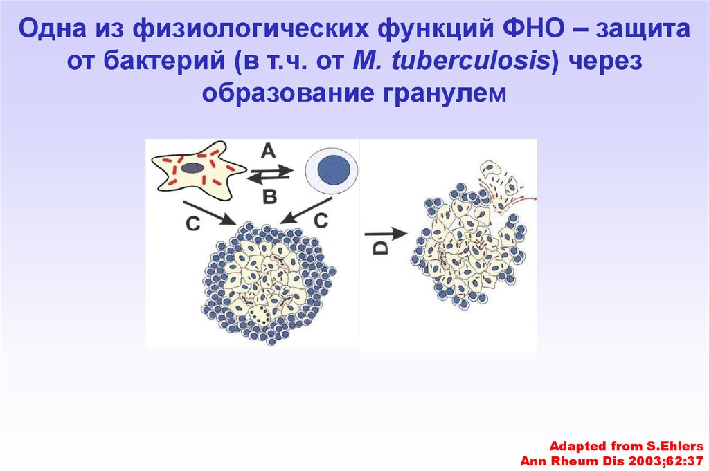 Фно это. Механизм образования гранулемы. Строение морфогенеза гранулемы вид.