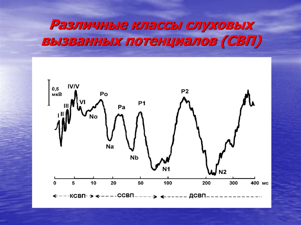 Регистрация слуховых вызванных потенциалов. Коротколатентные слуховые вызванные потенциалы (КСВП). Корковые слуховые вызванные потенциалы. Комплект стержневой военно-полевой КСВП. Вызванные потенциалы слуховые протокол.